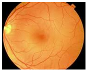 Dean Evans Optometrist - Gold Coast Optometrists 2