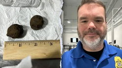 TSA officer sees alarming shapes on X-ray before stolen Civil War mystery unravels Gold Coast Optometrists